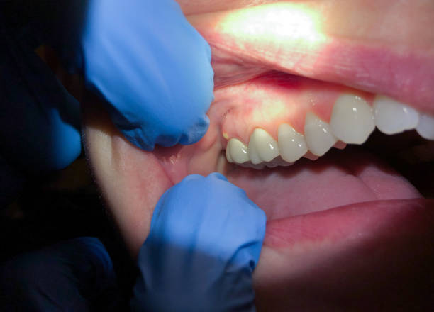 Best Emergency Orthodontic Repairs in Warner, OK